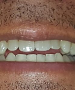 Zen Charcoal Hardwood Activated Charcoal Powder, 100% USA Trees, 8 oz 8 Ounce (Pack of 1) 36 7106a2Vn8PL