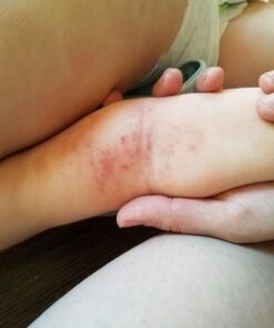 Hydrating Face Moisturizer & Body Cream with Manuka Honey Cream - Organic Face Moisturizer & Body Lotion for Extremely Dry Skin - For Dry & Itchy Skin, Rosacea & Eczema Prone Skin (Original, 2oz) Original 2 Ounce (Pack of 1) 43 710OqNEtx6L 1