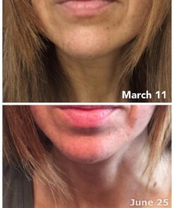 Natrol Biotin Beauty Tablets, Promotes Healthy Hair, Skin and Nails, Helps Support Energy Metabolism, Helps Convert Food Into Energy, Maximum Strength, 10,000mcg, 100 Count (Pack of 1) 100 Count (Pack of 1) 32 710TIQTwJL