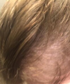 Saw Palmetto & Cayenne Scalp Oil For Hair Growth, Hair Loss Serum, Hair Oil For Dry Damaged Hair And Growth, Hair Growth Serum For Thicker Longer Fuller Healthier Hair, All Natural Vitamin Rich 42 7112Ws4kfdL