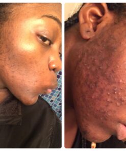 TROPICAL NATURAL Dudu Osun Black Soap, Basic, 31.74 Ounce 1.98 Pound (Pack of 1) 28 711BpEbMvdL