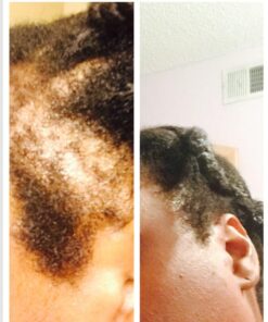 Naturenetics HairAnew Hair Growth Vitamins for Women & Men - Hair Vitamins For Faster Hair Growth & Thickness - Part of Proceeds go to Hair Loss Charity - Vegan Hair Supplement For Hair Skin Nails (1) 1 32 711Mt7GbS8L