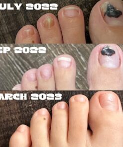 3 in 1 Professional Foot Spa Kit-with Tea Tree Foot & Body Soak-Tea Tree Body Wash & Nail Blend-Soothes Dry, Burning & Itchy Skin-Refreshes Unwanted Foot Odor-Restores Unhealthy Nails-Purely Northwest Tea Tree Oil 3 Piece Set 37 711ollRnjbL 1