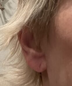 Lobe Wonder - The ORIGINAL Ear Lobe Support Patch for Pierced Ears - Eliminates the Look of Torn or Stretched Piercings - Protects Healthy Ear Lobes from Tearing - 60 Patches - Clear & Latex-Free 48 711r97uF72L