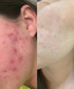 Zhou Nutrition Saw Palmetto Extract 500 mg, Prostate Health, Urinary Tract Support, DHT Blocker for Men and Women Hair Growth, Non-GMO, 100 Capsules (Packaging may vary) 24 7122cZIx5BL