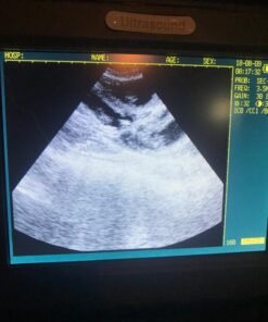 Portable Ultrasound Scanner Veterinary Pregnancy V12 with 3.5 MHz Convex Probe for Sheep, Dog, Cat and Pig. 20 712rl1hwqzL