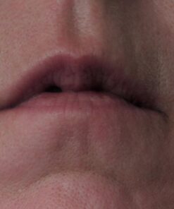 Silk’N Revit - Blackhead Remover Vacuum - Microdermabrasion Machine - Cleansing Exfoliating Face Scrub Pore Vacuum 54 713TWHuFyLL