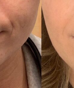 Hyaluronic Acid Serum for Skin 100% Pure Anti Aging Serum Intense Hydration Moisture Non greasy Paraben free, Wrinkle Reducing and Brightening Serum (Pro Formula) 2oz 2 Fl Oz (Pack of 1) 37 713gKfWhBpL