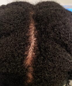 Neutrogena T/Sal Therapeutic Shampoo, Scalp Build-Up Control 4.5 oz, 130 fl oz 4.5 Fl Oz (Pack of 1) 30 714It1iaTFL