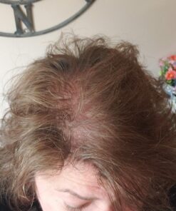 Hairgenics Pronexa Clinical Strength Hair Growth & Regrowth Therapy Hair Loss Shampoo With Biotin, Collagen, and DHT Blockers for Thinning Hair, 8 fl. oz. 40 714bsi5b5HL