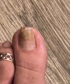 Kerasal Nail Renewal, Restores Appearance of Discolored or Damaged Nails, 0.33 fl oz (Packaging May Vary) 41 7152ExSVK3L