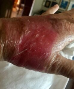 Silver Miracles Colloidal Silver Gel - Nano Silver Gel Wound Care - Healing Ointment for Burns, Sunburns & Irritated Skin - 4 Oz Unscented 44 715GMYAUDL 1