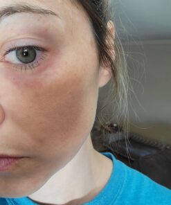 Active Skin Repair Hydrogel - Natural & Non-Toxic First Aid Ointment & Antiseptic Gel for Minor Cuts, Wounds, Scrapes, Rashes, Sunburns, and Other Skin Irritations (Single, 3 oz Gel) 3 Fl Oz (Pack of 1) 41 715dJLWIVVL