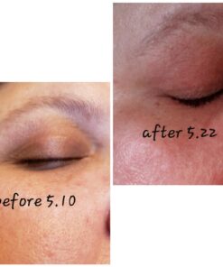 Hyaluronic Acid Serum for Skin 100% Pure Anti Aging Serum Intense Hydration Moisture Non greasy Paraben free, Wrinkle Reducing and Brightening Serum (Pro Formula) 2oz 2 Fl Oz (Pack of 1) 47 715wadCufVL