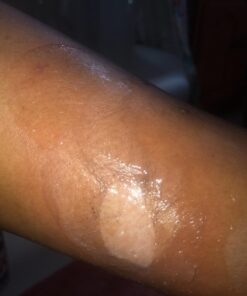 Active Skin Repair Hydrogel - Natural & Non-Toxic First Aid Ointment & Antiseptic Gel for Minor Cuts, Wounds, Scrapes, Rashes, Sunburns, and Other Skin Irritations (Single, 3 oz Gel) 3 Fl Oz (Pack of 1) 46 7161gZGbWtL