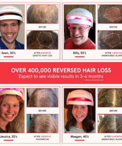 iRestore Essential Laser Hair Growth System - FDA Cleared Hair Loss Treatments for Men & Women & Hair Growth Products for Men with Thinning Hair, Hair Regrowth Treatments Laser Cap, Red Light Therapy 28 7163jlmKMNL 1