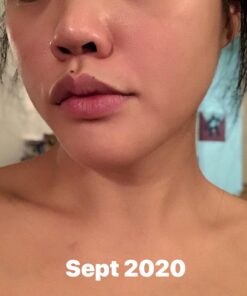 Estroblock PRO Triple Strength - 60 Capsules, DIM & Indole 3-Carbinol for Natural Hormonal Hormone Balance, Acne - Anti Toxic Estrogen Aromatase Inhibitor Blocker. Soy Free, Dairy Free, Non-GMO (1) 1 66 716Bds2CbL 4