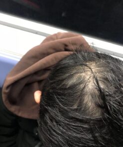 artnaturals Moroccan Argan Oil Hair Loss Shampoo & Conditioner Set - (2 x 16 Fl Oz / 473ml) - Sulfate Free Hair Regrowth - Treatment for Hair Loss, Thinning Hair & Hair Growth, Men & Women 16 Fl Oz (Pack of 2) 28 716QrFbv9JL