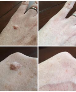 Dr. Scholl's Clear Away WART Remover HYDROGEL Bandage // 12 Discs/9 Cushions, Clinically Proven, Immediate & All-Day Cushioning Pain Relief, Multi-Day Coverage, 12 Treatments 36 716ieZpu0xL