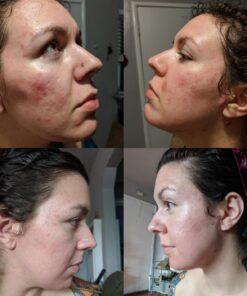 Hada Labo Tokyo Skin Plumping Gel Cream with Super Hyaluronic Acid & Collagen, 1.76 Fl Oz, Non-Comedogenic, Unscented 51 717JFDsclQL