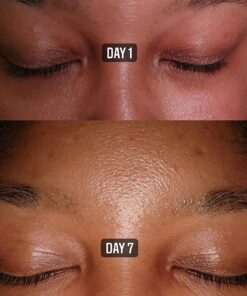 Sky Organics Organic Castor Oil Eyelash Serum for Lashes & Brows, 100% Pure & Cold-Pressed USDA Certified Organic to Strengthen, Moisturize & Condition, 1 fl. Oz 36 717TRZ7y2zL 3