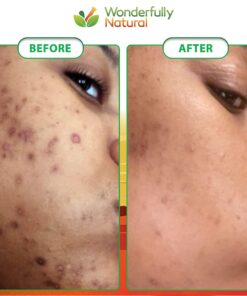 Organic African Black Soap - For Acne & Dark Spots | Natural Vegan and Cruelty Free – Satisfaction Guarantee 1lb bar | 90 day Supply 1 Pound (Pack of 1) 33 717WaWUFa7L 1