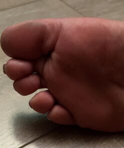 Dr. Frederick's Original Hammer Toe Gels - 4pcs - Hammer Toe Support Crest for Women & Men - Joint Realign - Cushion, Support & Temporary Splint - Crooked, Claw, Diabetic Toe Brace - 3 Loop Design 3 Loops 34 717ttHREDSL