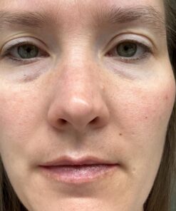 Paulas Choice--SKIN PERFECTING 2% BHA Liquid Salicylic Acid Exfoliant--Facial Exfoliant for Blackheads, Enlarged Pores, Wrinkles & Fine Lines, 4 oz Bottle 4.00 Fl Oz (Pack of 1) 28 718FLNqnzL