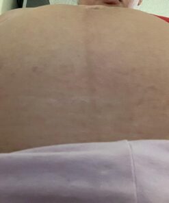 Skinception Intensive Stretch Mark Cream Therapy, 4 Fluid Ounce 14 718VgaSQgDL