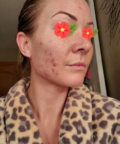 Sports Research Vitamin D3 5000 IU with Coconut MCT Oil - High Potency Vitamin D Supplement for Immune & Bone Support - Non-GMO Verified, Gluten & Soy Free – 125mcg, 360 Liquid Softgels 360 Count (Pack of 1) 36 718xs KhpL