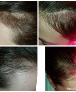 DrFormulas HairOmega 3-in-1 Hair Growth Vitamins with DHT Blocker, Biotin for Women & Men | Hair Skin and Nails Supplement for Hair Loss, 120 Pills 120 Count (Pack of 1) 35 7194tA17PsL