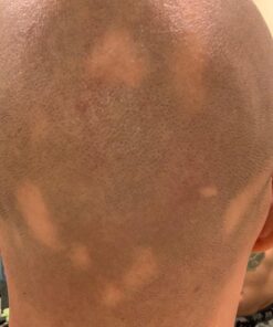 Saw Palmetto & Cayenne Scalp Oil For Hair Growth, Hair Loss Serum, Hair Oil For Dry Damaged Hair And Growth, Hair Growth Serum For Thicker Longer Fuller Healthier Hair, All Natural Vitamin Rich 30 719bjpC0KlL