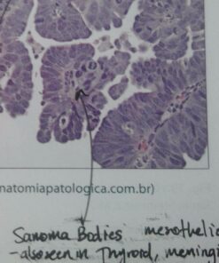 Uniball Jetstream RT 3 Pack, 0.7mm Fine Black, Wirecutter Best Pen, Ballpoint Pens, Ballpoint Ink Pens | Office Supplies, Pens, Ballpoint Pen, Colored Pens, Fine Point, Smooth Writing Pens 34 719gdSd6wqL