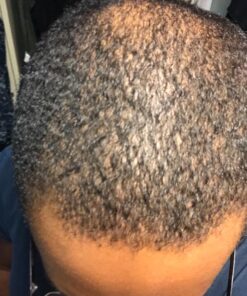 DrFormulas HairOmega 3-in-1 Hair Growth Vitamins with DHT Blocker, Biotin for Women & Men | Hair Skin and Nails Supplement for Hair Loss, 120 Pills 120 Count (Pack of 1) 41 719ltWQqTyL