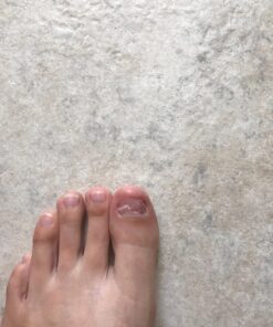 PURELY NORTHWEST-Natural Tea Tree & Peppermint Body Wash for Men & Women-Refreshing Daily Soap for Body Odor & Hygiene, Acne-Effectively Soothes Jock Itch, Chafing & Athletes Foot-Discolored Nails-9oz 9 Fl Oz (Pack of 1) 41 71A98o7zwVL