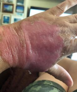 Silver Miracles Colloidal Silver Gel - Nano Silver Gel Wound Care - Healing Ointment for Burns, Sunburns & Irritated Skin - 4 Oz Unscented 45 71AHJ9A7z1L 1