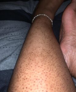 PURELY NORTHWEST-Natural Tea Tree & Peppermint Body Wash for Men & Women-Refreshing Daily Soap for Body Odor & Hygiene, Acne-Effectively Soothes Jock Itch, Chafing & Athletes Foot-Discolored Nails-9oz 9 Fl Oz (Pack of 1) 49 71AL3iO49EL