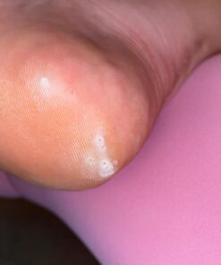 Compound W Maximum Strength Fast Acting Liquid Wart Remover, 0.31 fl oz 43 71Am3 RDppL