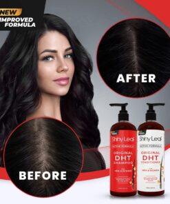 DHT Blocker Shampoo and Conditioner for Hair Loss With Biotin For Men, Women, Anti-Hair Loss Treatment, Rosemary Leaf Oil and Asparagus Extracts, for Thinning Hair (Shampoo and Conditioner) 16 Fl Oz (Pack of 2) 25 71BQpFbY7 L