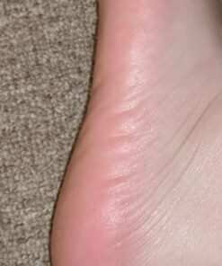 Microplane Colossal Foot File Scraper - The Original Stainless Steel Foot Rasp, Dead Skin/Callus Remover for Feet, Gentle Foot Scrubber, Pedicure Tools for Salon-Quality Foot Care, Black 56 71BWB4ONGBL