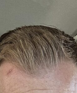 Nutrafol Men's Hair Growth Supplements, Clinically Tested for Visibly Thicker Hair and Scalp Coverage, Dermatologist Recommended - 1 Month Supply 57 71C2ZlmzkL