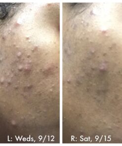 Aspen Kay Naturals Handmade Dead Sea Mud Soap Bar, Activated Charcoal & Pure Essential Oils, 4.5 oz Bar 1 Pack 40 71CTlbzgML