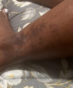 Organic Aloe Vera Gel - 100% Pure for Skin, Sunburn Relief & Face Moisturizer - Extracted from Aloe Vera Plant with Manuka Honey, Orchid & Apple Stem Cells - Everyday Use - 8 Fl Oz 8 Fl Oz (Pack of 1) 38 71CWzjLS7cL