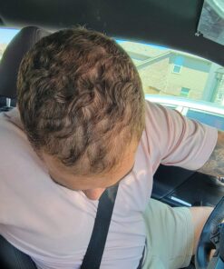 iRestore Essential Laser Hair Growth System - FDA Cleared Hair Loss Treatments for Men & Women & Hair Growth Products for Men with Thinning Hair, Hair Regrowth Treatments Laser Cap, Red Light Therapy 47 71CkErAurCL 1