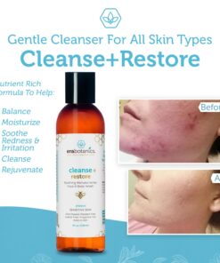 Manuka Honey Face Wash for Women and Men - Moisturizing Face Wash for Dry Skin with Organic Aloe Vera - Soothing Gentle Face Cleanser Made in USA - Sulfate Free Facial Cleanser for Dry Skin 4 oz 4 Fl Oz (Pack of 1) 17 71DBnWMFBCL