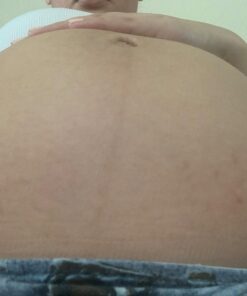 Skinception Intensive Stretch Mark Cream Therapy, 4 Fluid Ounce 15 71DDy3wHRGL