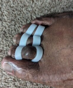 Dr. Frederick's Original Hammer Toe Gels - 4pcs - Hammer Toe Support Crest for Women & Men - Joint Realign - Cushion, Support & Temporary Splint - Crooked, Claw, Diabetic Toe Brace - 3 Loop Design 3 Loops 33 71DflQB7lcL