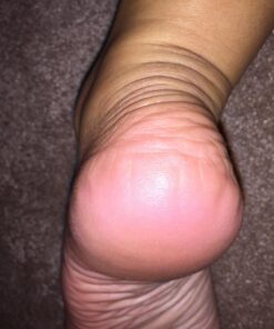 Microplane Colossal Foot File Scraper - The Original Stainless Steel Foot Rasp, Dead Skin/Callus Remover for Feet, Gentle Foot Scrubber, Pedicure Tools for Salon-Quality Foot Care, Black 66 71DlUJwlyrL