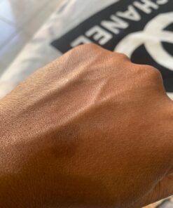 Gold Bond Healing Hydrating Lotion, 20 oz., With Aloe, Moisturizes, Immediate 24-Hour Hydration 20 Ounce (Pack of 1) 34 71E8QRsw1BL