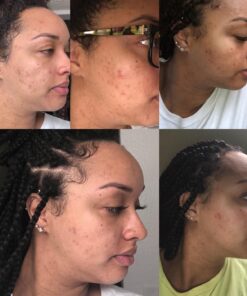 Sky Organics African Black Soap Bar for Body to Cleanse, Soothe & Refresh, 16 Oz 1 Pound (Pack of 1) 52 71EDWcjoL